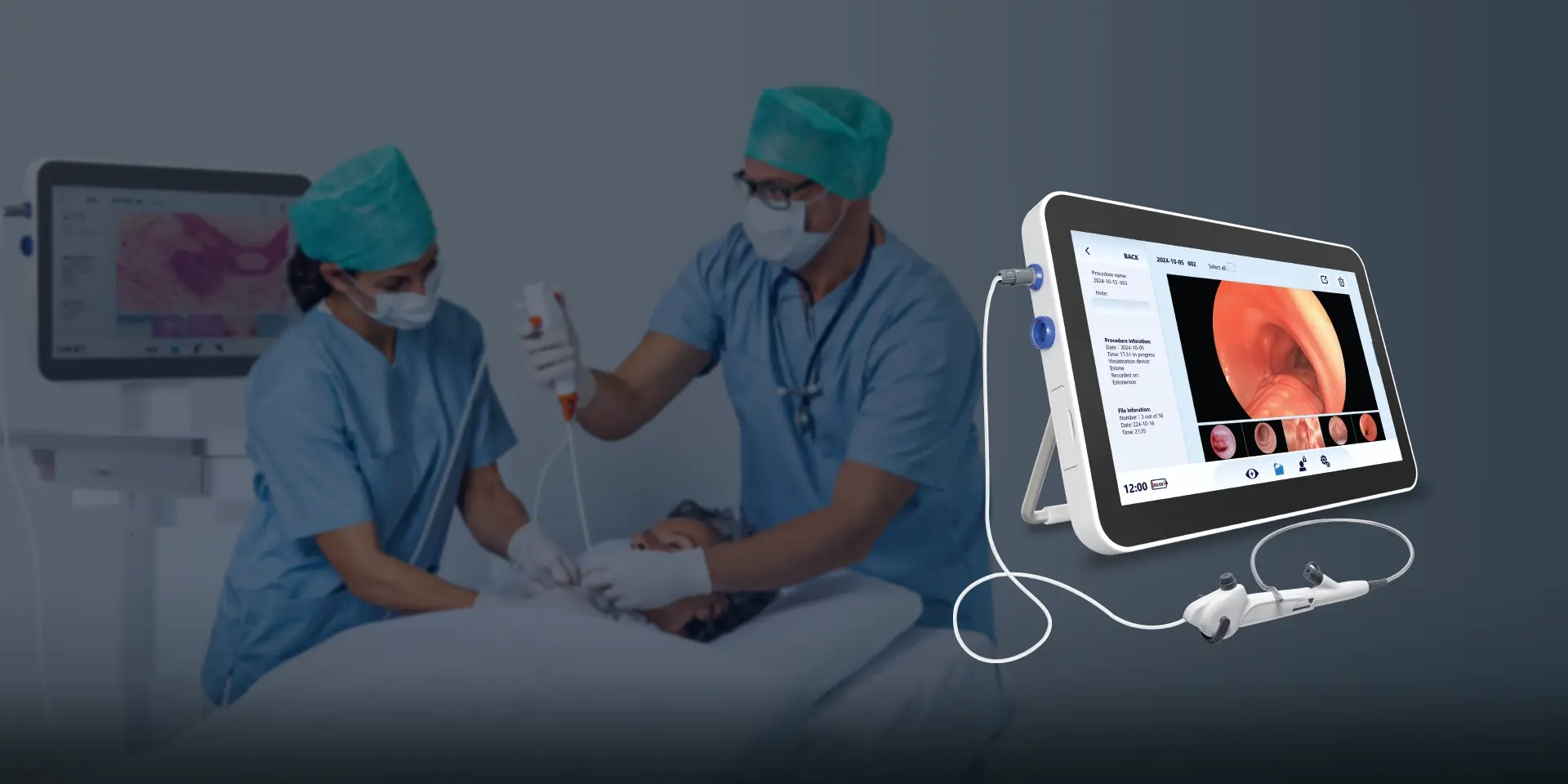 EN-150 Portable Endoscopy