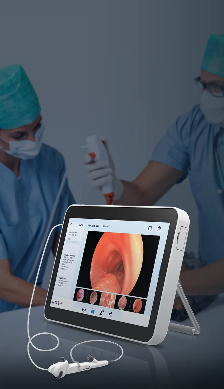 EN-150 Portable Endoscopy